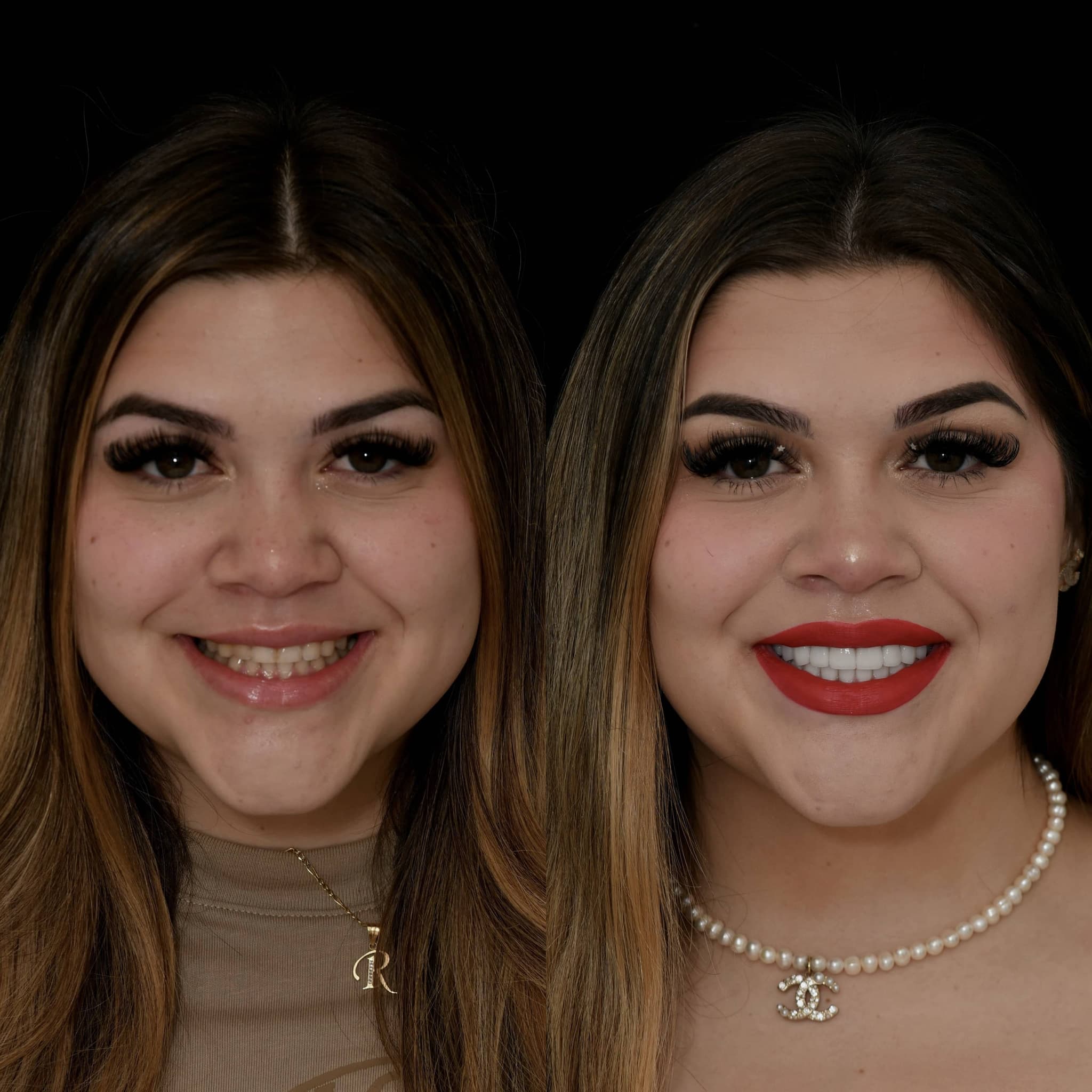 Cosmetic dentistry transformation
