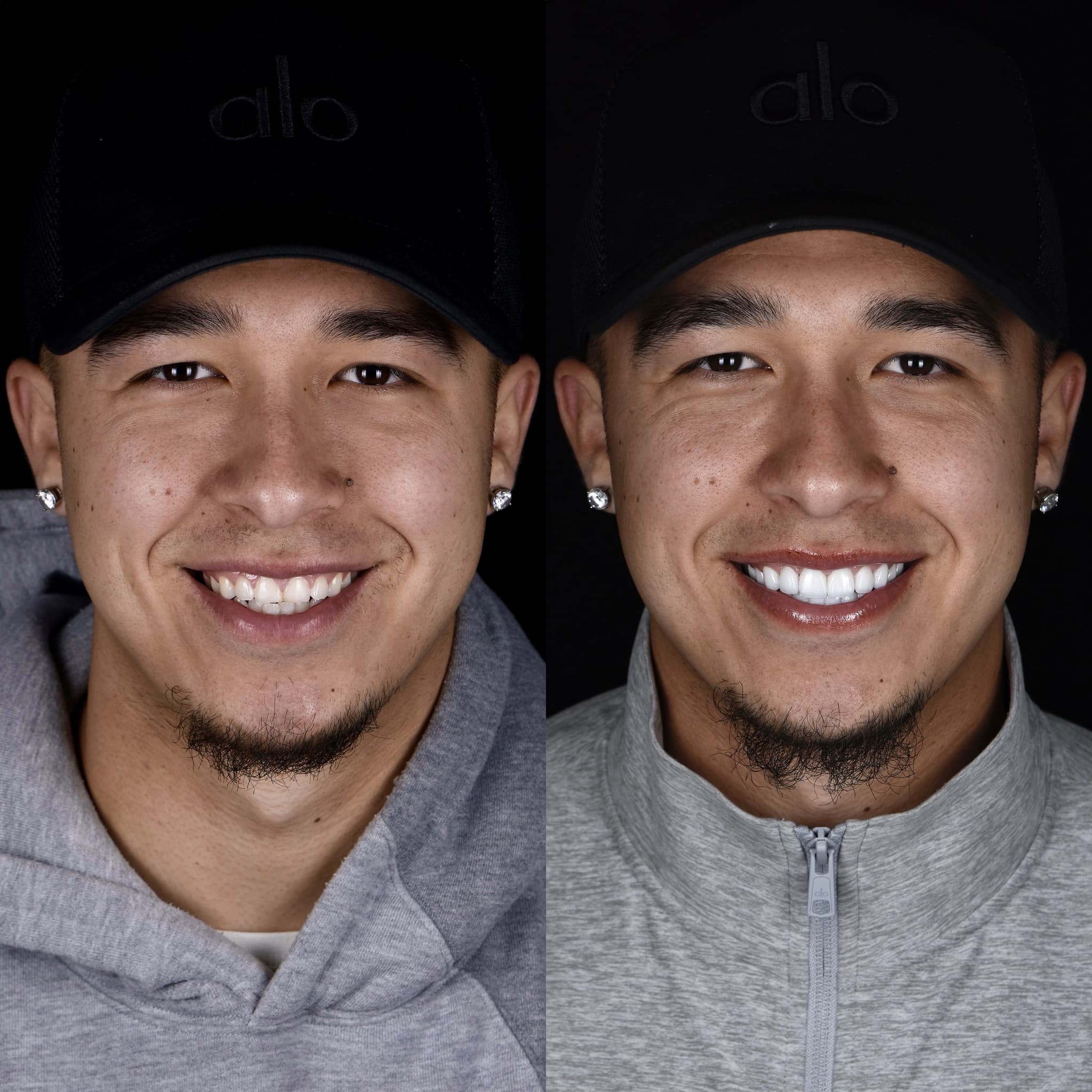Porcelain before and after
